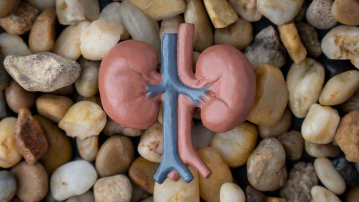 comment dissoudre les calculs rénaux en 8 jours