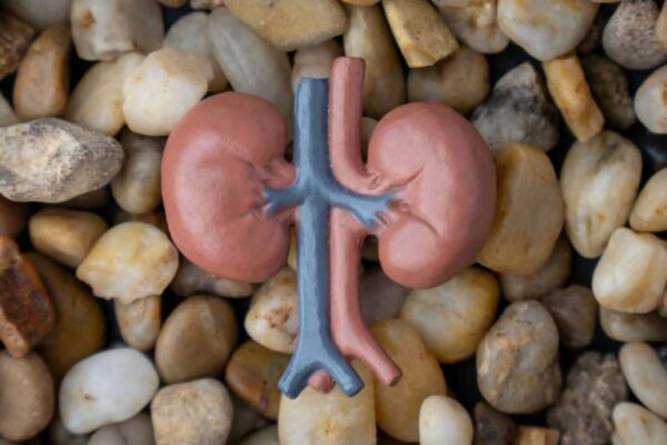 comment dissoudre les calculs rénaux en 8 jours