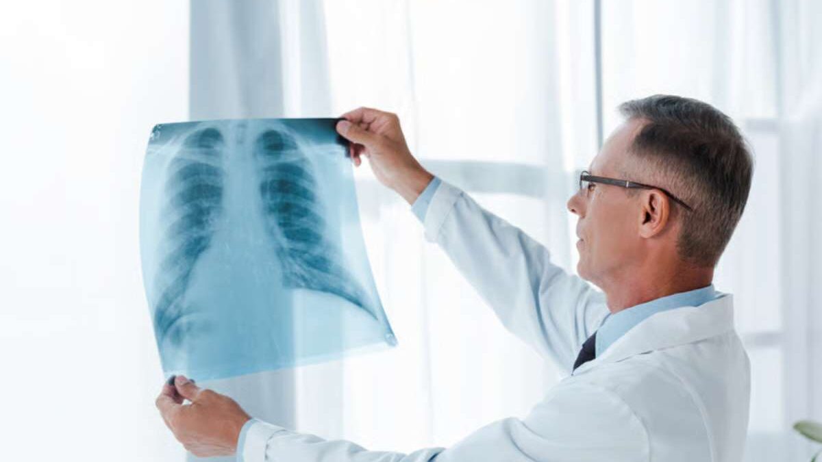 quels sont les symptômes de la sarcoïdose