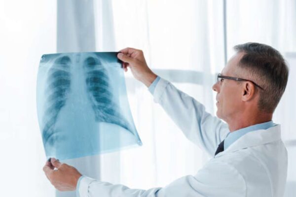 quels sont les symptômes de la sarcoïdose